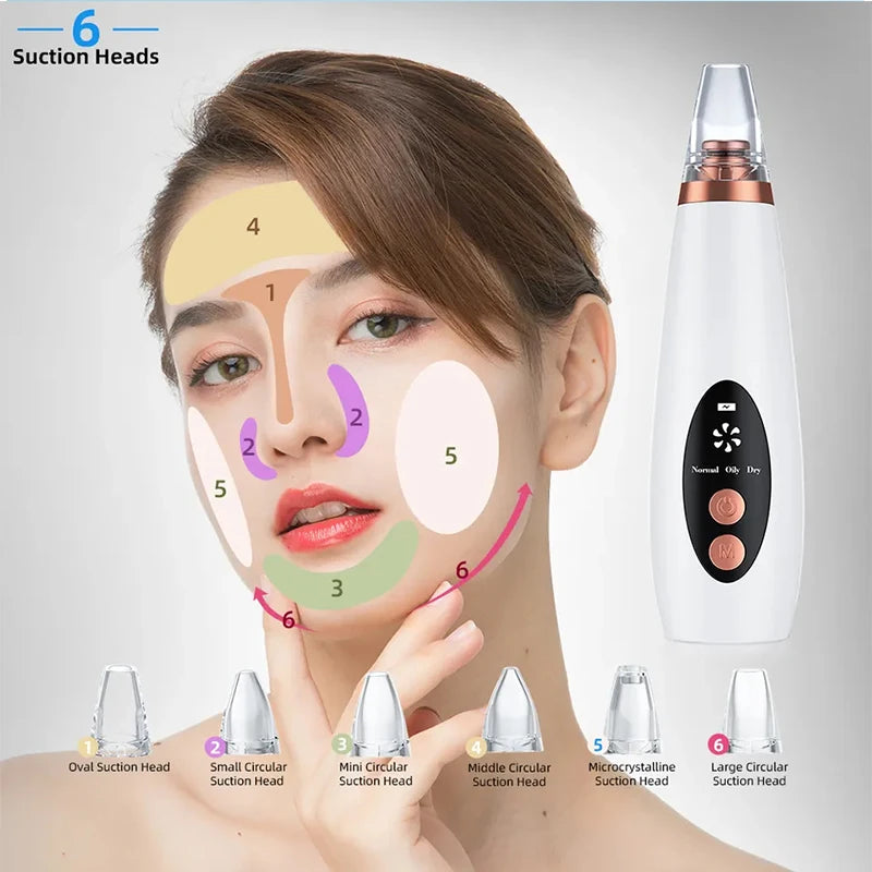 Portable Blackhead Vacuum Device For All Skin Types